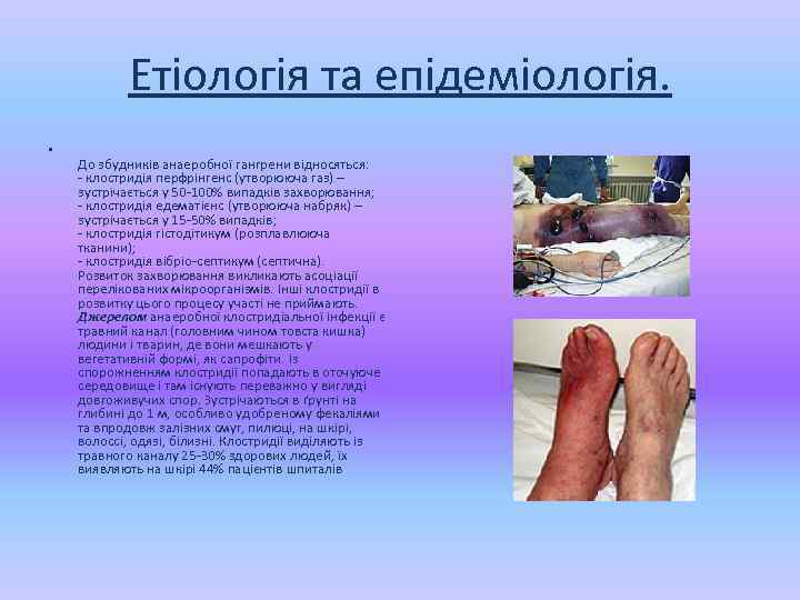 Етіологія та епідеміологія. • До збудників анаеробної гангрени відносяться: - клостридія перфрінгенс (утворююча газ)