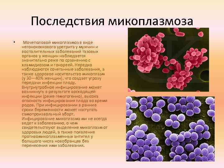 Микоплазма чем лечить. Урогенитальный микоплазмоз симптомы. Микоплазменная инфекция у женщин. Микоплазма проявление.