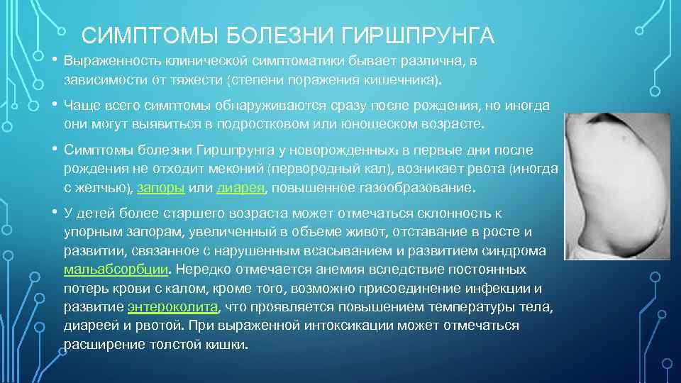 СИМПТОМЫ БОЛЕЗНИ ГИРШПРУНГА • Выраженность клинической симптоматики бывает различна, в зависимости от тяжести (степени