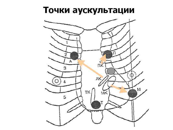 Точки аускультации 