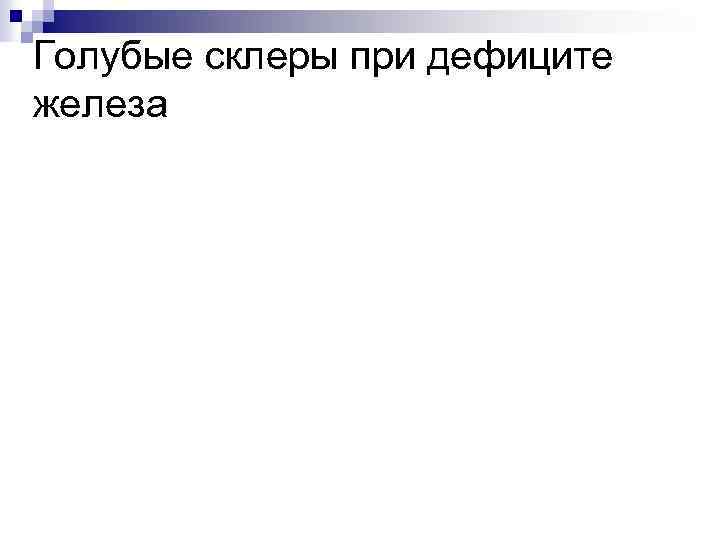 Голубые склеры при дефиците железа 