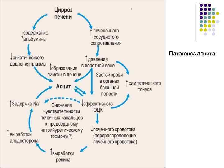 Патогенез асцита 