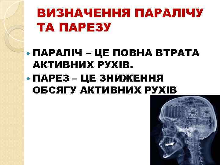 ВИЗНАЧЕННЯ ПАРАЛІЧУ ТА ПАРЕЗУ ПАРАЛІЧ – ЦЕ ПОВНА ВТРАТА АКТИВНИХ РУХІВ. ПАРЕЗ – ЦЕ