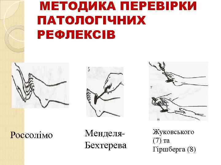  МЕТОДИКА ПЕРЕВІРКИ ПАТОЛОГІЧНИХ РЕФЛЕКСІВ Россолімо Менделя. Бехтерева Жуковського (7) та Гіршберга (8) 