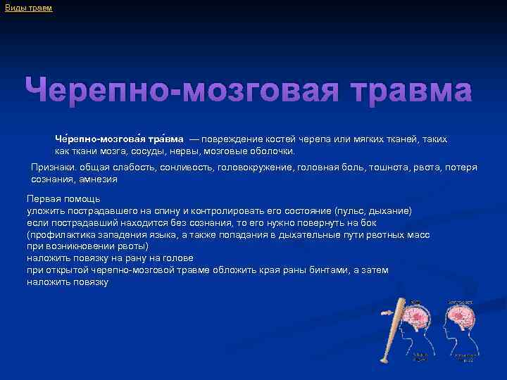 Виды травм Черепно-мозговая травма Че репно-мозгова я тра вма — повреждение костей черепа или