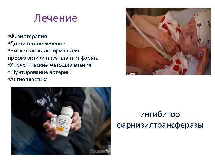 Лечение • Физиотерапия • Диетическое лечение • Низкие дозы аспирина для профилактики инсульта и