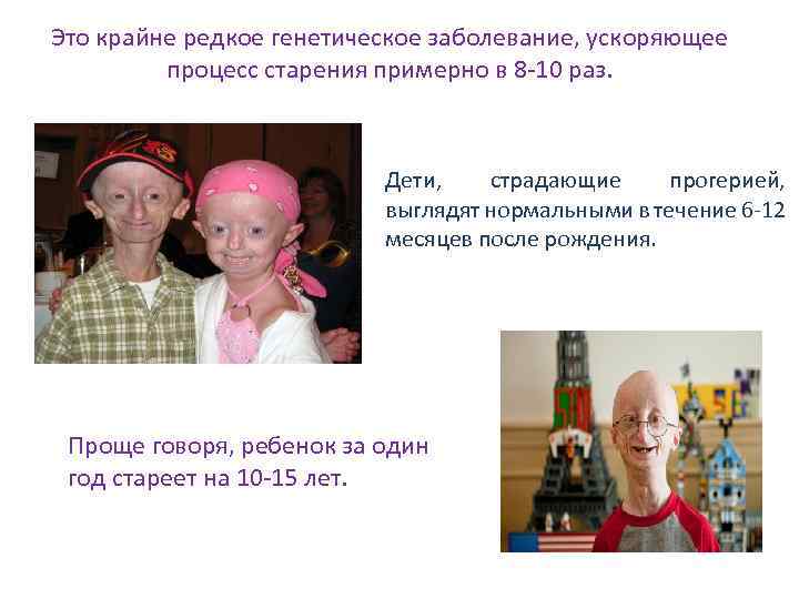 Это крайне редкое генетическое заболевание, ускоряющее процесс старения примерно в 8 -10 раз. Дети,