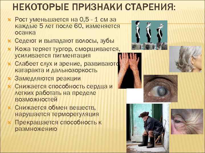 НЕКОТОРЫЕ ПРИЗНАКИ СТАРЕНИЯ: Рост уменьшается на 0, 5 - 1 см за каждые 5