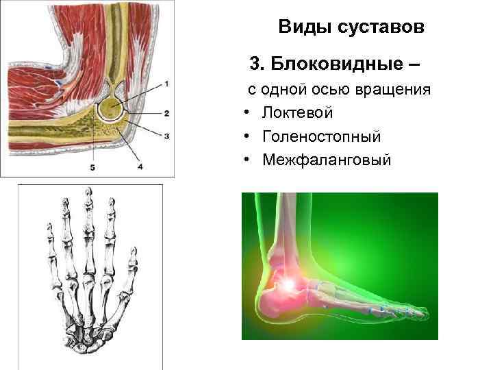 Виды суставов 3. Блоковидные – с одной осью вращения • Локтевой • Голеностопный •