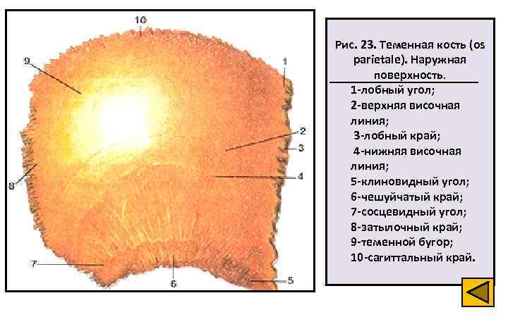 Рис. 23. Теменная кость (os parietale). Наружная поверхность. 1 -лобный угол; 2 -верхняя височная