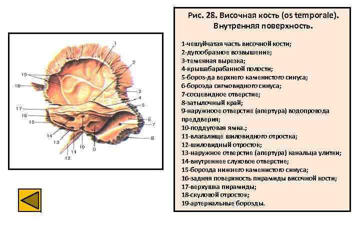 Рис. 28. Височная кость (os temporale). Внутренняя поверхность. 1 -чешуйчатая часть височной кости; 2