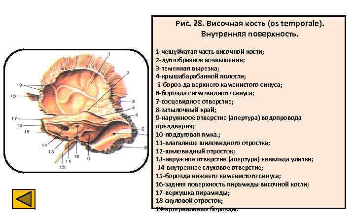 Рис. 28. Височная кость (os temporale). Внутренняя поверхность. 1 -чешуйчатая часть височной кости; 2