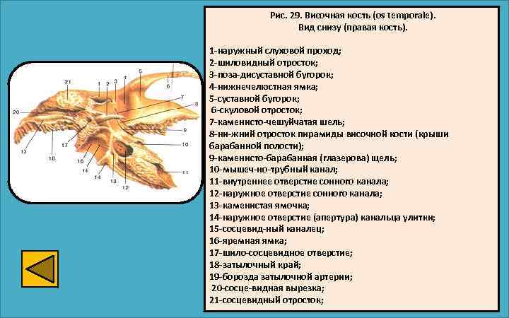 Рис. 29. Височная кость (os temporale). Вид снизу (правая кость). 1 -наружный слуховой проход;
