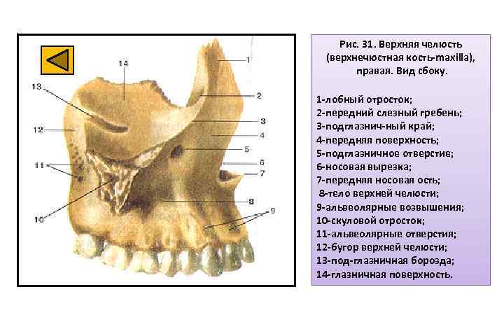 Рис. 31. Верхняя челюсть (верхнечюстная кость-maxilla), правая. Вид сбоку. 1 -лобный отросток; 2 -передний