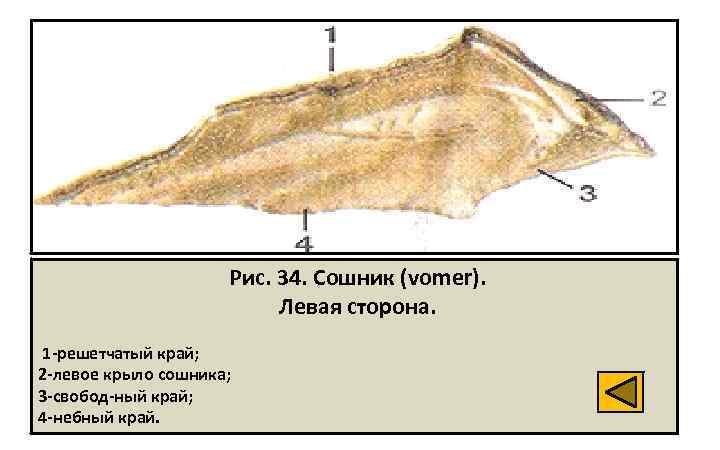 Сошник носа фото