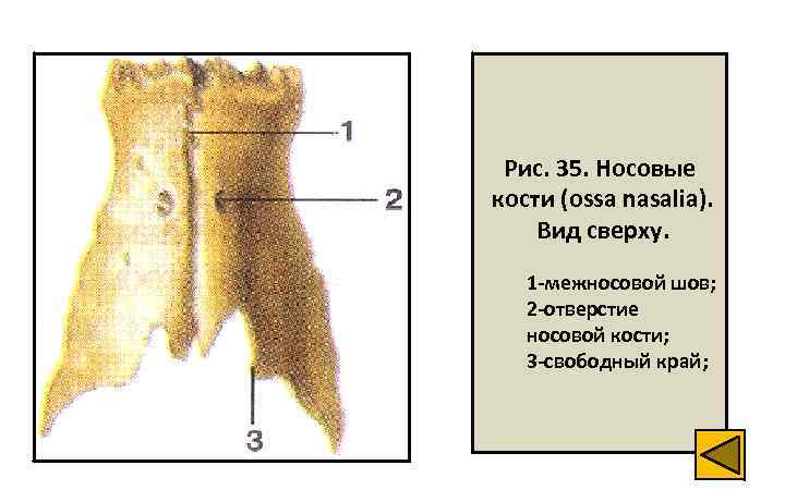 Носовая кость