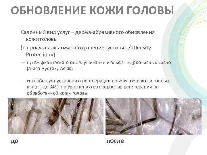 ОБНОВЛЕНИЕ КОЖИ ГОЛОВЫ Салонный вид услуг – дерма-абразивного обновления кожи головы (+ продукт для
