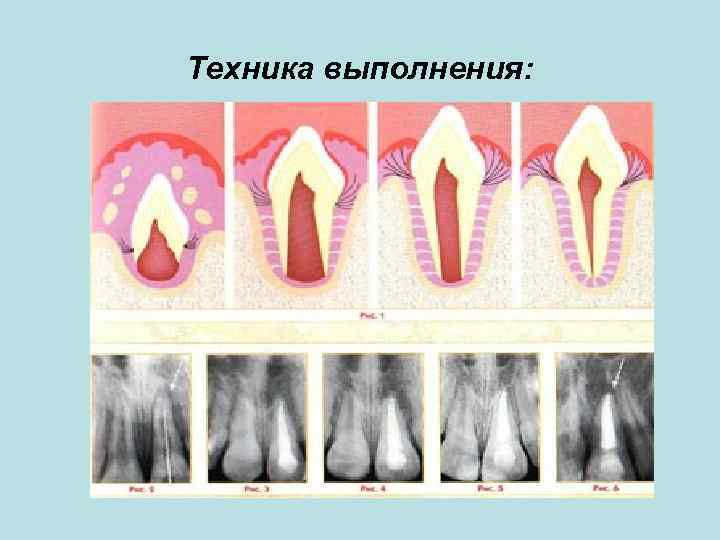 Техника выполнения: 