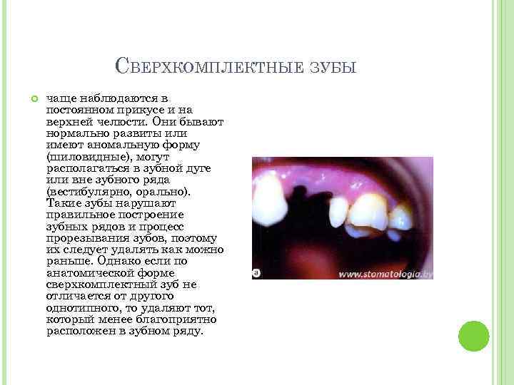 СВЕРХКОМПЛЕКТНЫЕ ЗУБЫ чаще наблюдаются в постоянном прикусе и на верхней челюсти. Они бывают нормально