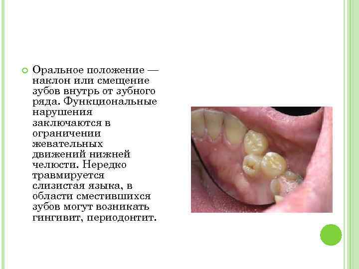  Оральное положение — наклон или смещение зубов внутрь от зубного ряда. Функциональные нарушения