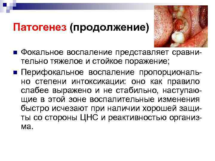 Патогенез (продолжение) n n Фокальное воспаление представляет сравнительно тяжелое и стойкое поражение; Перифокальное воспаление