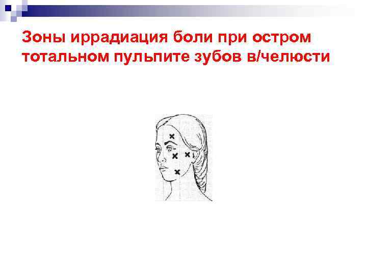 Зоны иррадиация боли при остром тотальном пульпите зубов в/челюсти 