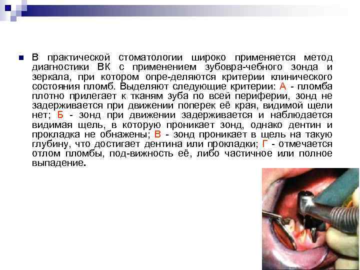 n В практической стоматологии широко применяется метод диагностики ВК с применением зубовра-чебного зонда и