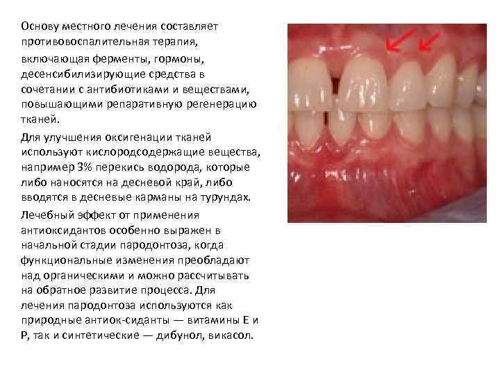Основу местного лечения составляет противовоспалительная терапия, включающая ферменты, гормоны, десенсибилизирующие средства в сочетании с
