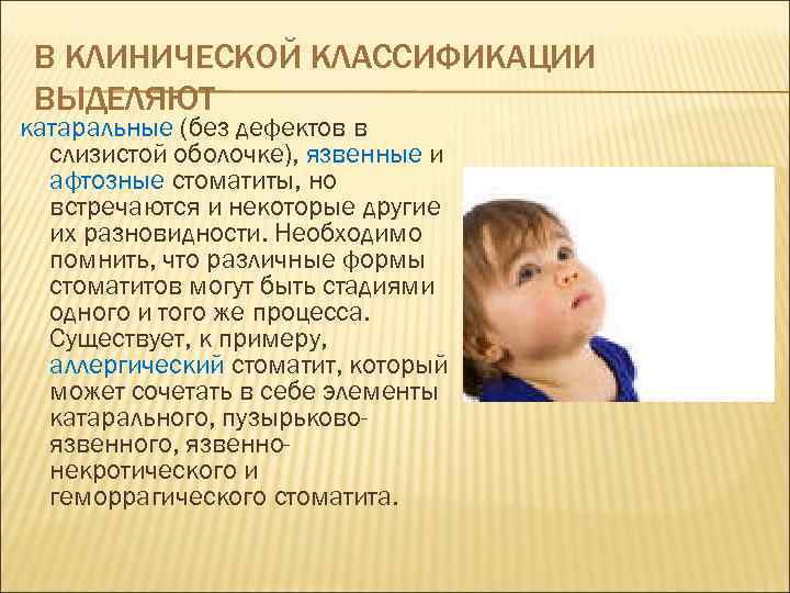 В КЛИНИЧЕСКОЙ КЛАССИФИКАЦИИ ВЫДЕЛЯЮТ катаральные (без дефектов в слизистой оболочке), язвенные и афтозные стоматиты,