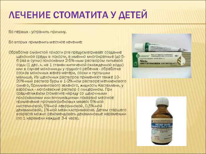 ЛЕЧЕНИЕ СТОМАТИТА У ДЕТЕЙ Во первых - устранить причину. Во вторых применить местное лечение: