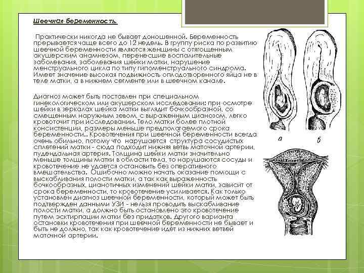 Шеечная беременность фото
