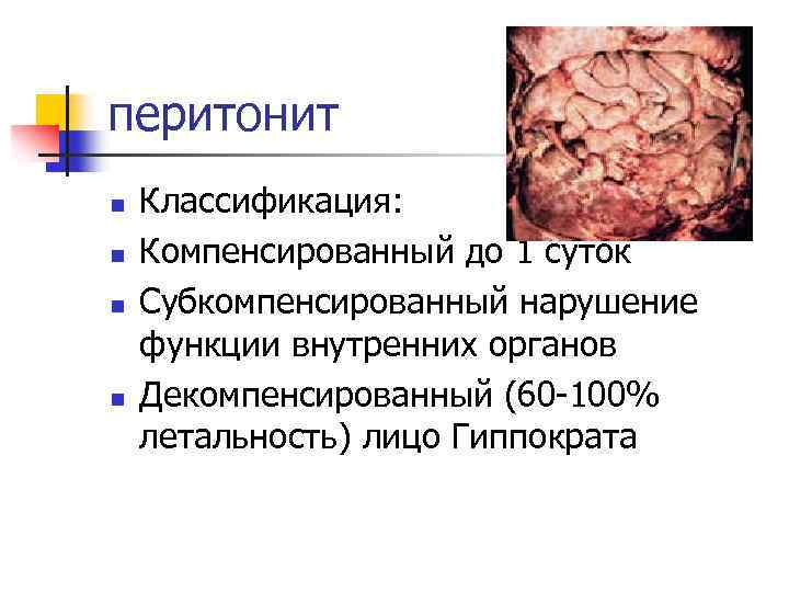перитонит n n Классификация: Компенсированный до 1 суток Субкомпенсированный нарушение функции внутренних органов Декомпенсированный