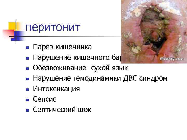 перитонит n n n n Парез кишечника Нарушение кишечного барьера Обезвоживание сухой язык Нарушение