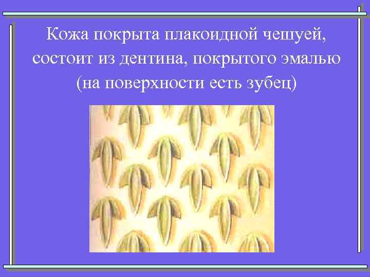 Кожа покрыта плакоидной чешуей, состоит из дентина, покрытого эмалью (на поверхности есть зубец) 