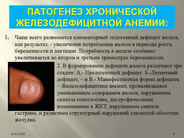 ПАТОГЕНЕЗ ХРОНИЧЕСКОЙ ЖЕЛЕЗОДЕФИЦИТНОЙ АНЕМИИ: 1. Чаще всего развивается алиментарный эндогенный дефицит железа, как результат,