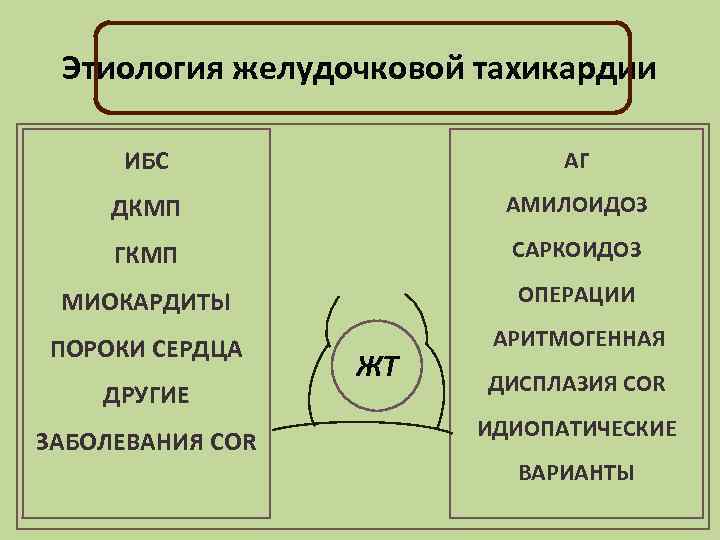 Этиология желудочковой тахикардии ИБС АГ ДКМП АМИЛОИДОЗ ГКМП САРКОИДОЗ МИОКАРДИТЫ ОПЕРАЦИИ ПОРОКИ СЕРДЦА АРИТМОГЕННАЯ