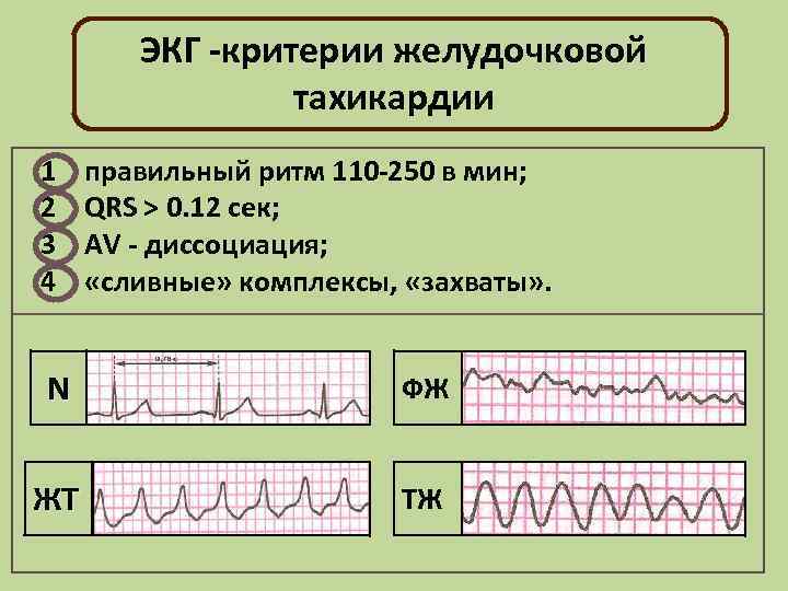 Правильный ритм