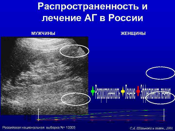 Распространенность и лечение АГ в России МУЖЧИНЫ Российская национальная выборка N= 13305 ЖЕНЩИНЫ С.
