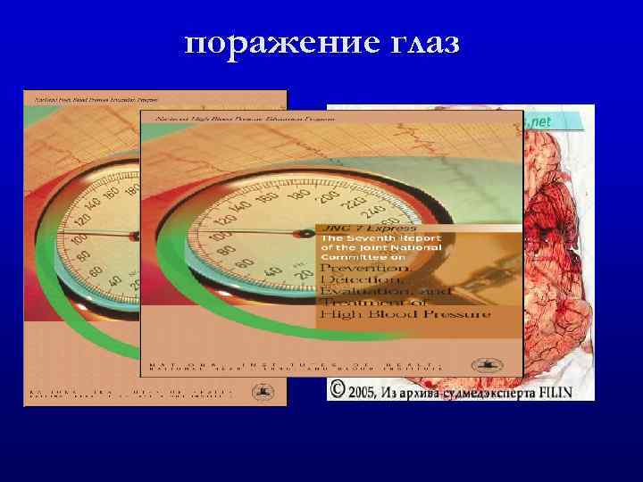 поражение глаз 