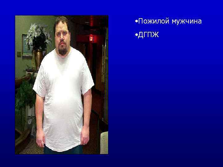  • Пожилой мужчина • ДГПЖ 