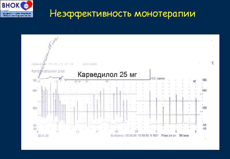 Неэффективность монотерапии Карведилол 25 мг 