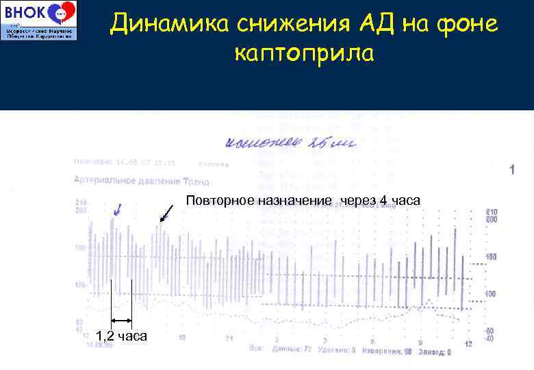 Динамика снижения АД на фоне каптоприла Повторное назначение через 4 часа 1, 2 часа