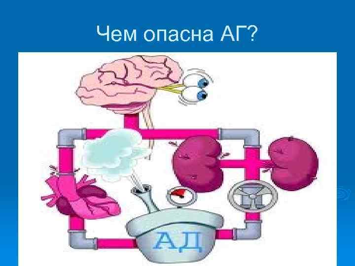 Чем опасна АГ? 