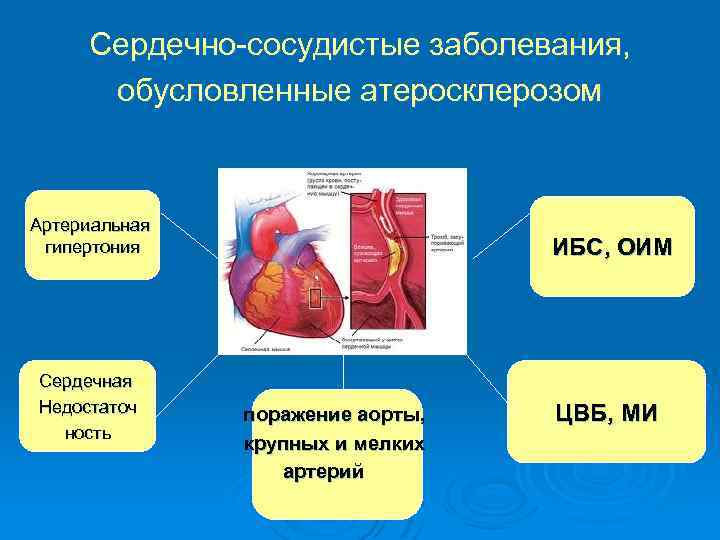 Сердечно-сосудистые заболевания, обусловленные атеросклерозом Артериальная гипертония Сердечная Недостаточ ность ИБС, ОИМ поражение аорты, крупных