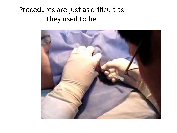 Procedures are just as difficult as they used to be 