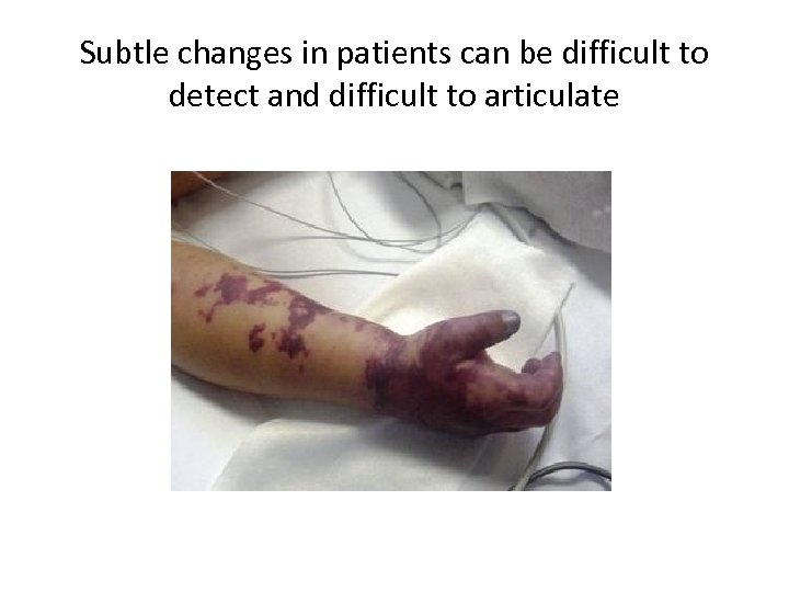 Subtle changes in patients can be difficult to detect and difficult to articulate 