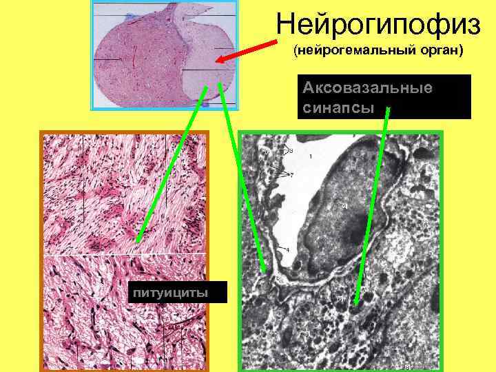 Нейрогипофиз (нейрогемальный орган) Аксовазальные синапсы питуициты 