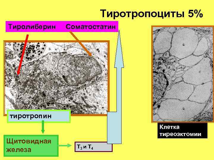 Тиротропоциты 5% Тиролиберин Соматостатин тиротропин Щитовидная железа Клетка тиреоэктомии Т 3 и Т 4