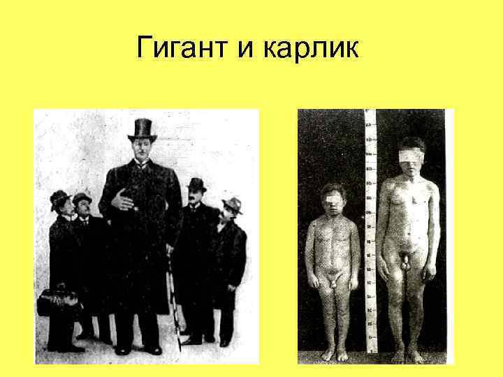 Гигант и карлик 