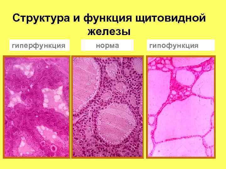 Структура и функция щитовидной железы гиперфункция норма гипофункция 